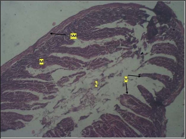 Low dose showing numerous epithelial cells in the mucosa (m) with villi projecting towards the lumen (l). The is focal metaplasia of the mucosal cells with villous disruption. smooth muscle layer appears normal. H & E. X40