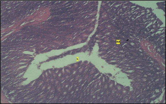 Control showing the lumen (l), the epithelial cells lining the mucosa (m) appearing normal H & E. X40.
