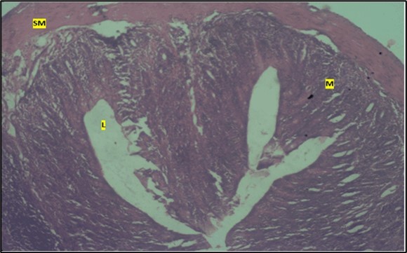 High dose showing the lumen (l), the smooth muscle layer(sm). mucosa (m) shows mild dysplasia H & E. X40.