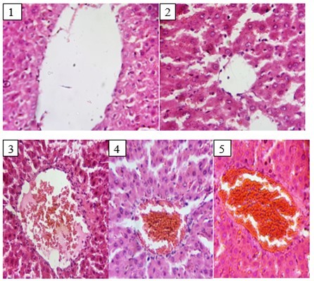 Effect of Extracts of D. guineense Stem Bark on Histology of Rats Liver.