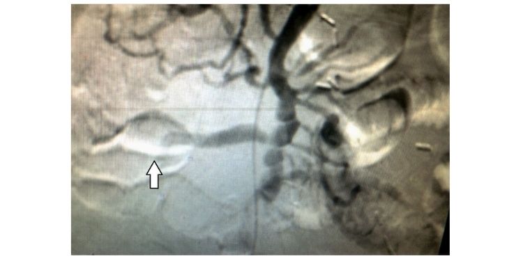 Journal of Digestive Disorders And Diagnosis-splanchnic