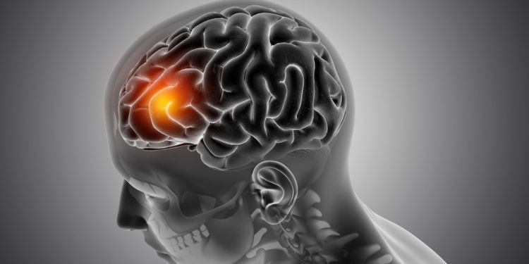 Journal of Otolaryngology Advances - neurodegenerative diseases